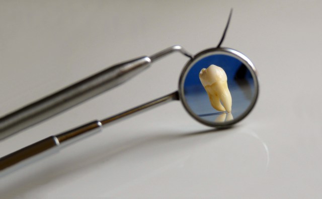 CALD workers discuss gaps in oral care