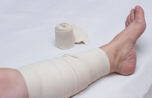 Leg of an elderly woman bandaged with an elastic bandage against varicose veins on the leg, close-up, white background, phlebeurysm