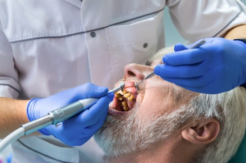 Senior dental scheme urgent, research shows
